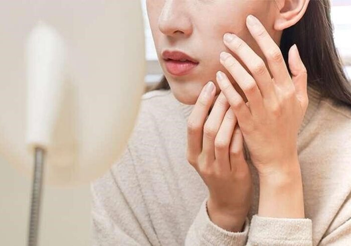 زیبایی پوست صورت به کمک طب سنتی